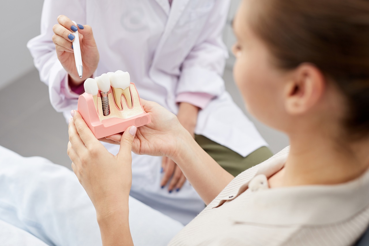 Implanty zębów – co warto wiedzieć?